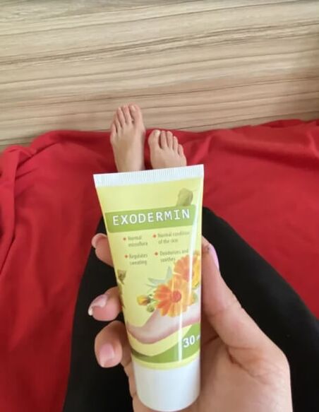 Review of Exodermin cream from Yesenia