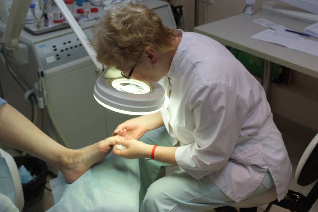 Effective growth of toenail fungus requires the help of a surgeon